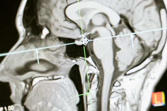 Dopamine’s Role in Addiction: Exploring L-Tyrosine as a Potential Aid for Withdrawal